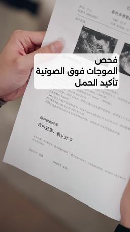 حبيبة الطفولة تخطف القلوب episode 87